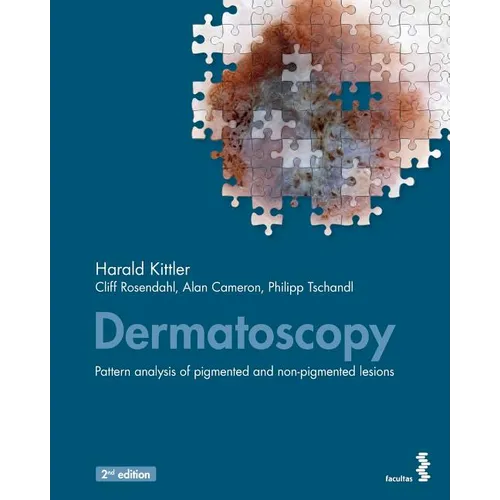 Dermatoscopy: Pattern analysis of pigmented and non-pigmented lesions