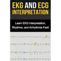 EKG and ECG Interpretation: Learn EKG Interpretation, Rhythms, and Arrhythmia Fast!