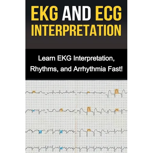 EKG and ECG Interpretation: Learn EKG Interpretation, Rhythms, and Arrhythmia Fast!