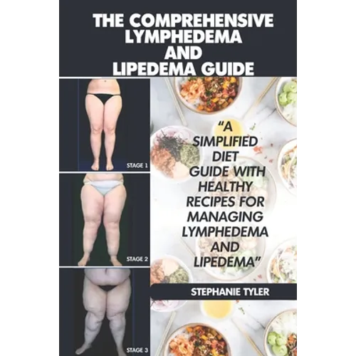 The Comprehensive Lymphedema and Lipedema Guide: The Comprehensive Lymphedema and Lipedema Guide