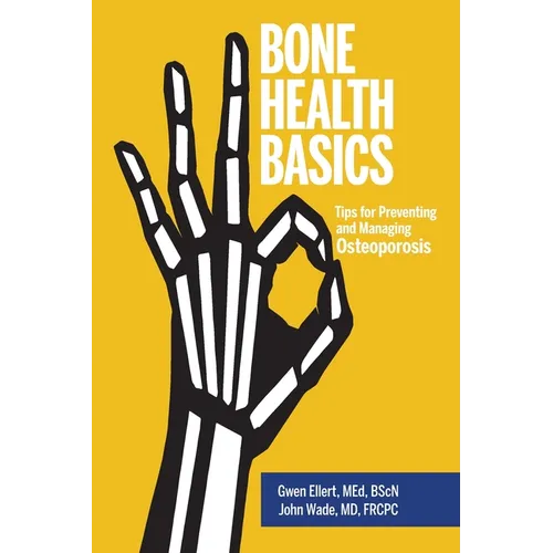 Bone Health Basics: Tips for Preventing and Managing Osteoporosis