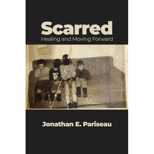 Scarred: Healing and Moving Forward