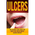 Ulcers: The Ultimate Cure Guide for How to Get Rid of Mouth Ulcers Instantly