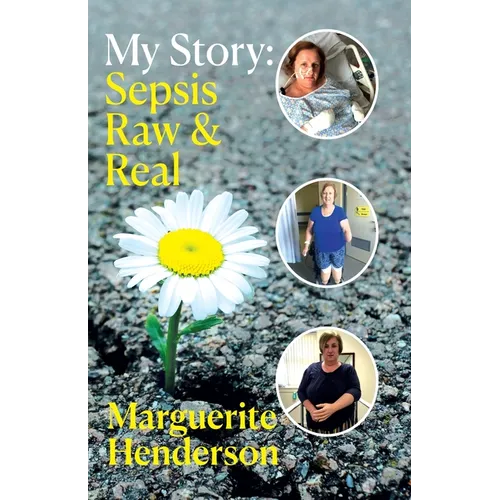 My Story: Sepsis Raw and Real