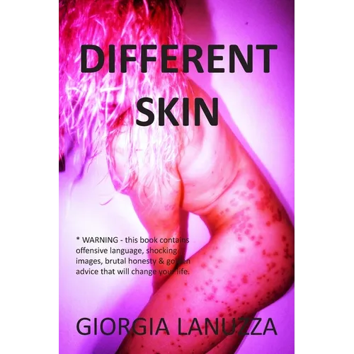 Different Skin
