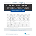 Essential Concepts of Electrophysiology Through Case Studies: Intracardiac EGMs: Intracardiac EGMs