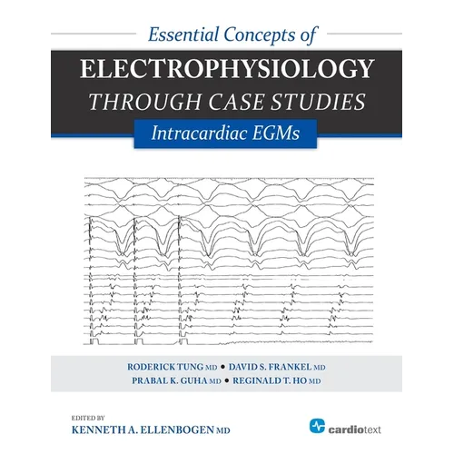 Essential Concepts of Electrophysiology Through Case Studies: Intracardiac EGMs: Intracardiac EGMs