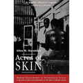 Acres of Skin: Human Experiments at Holmesburg Prison
