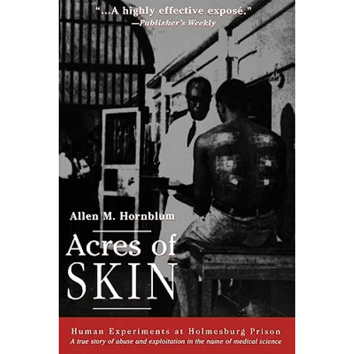 Acres of Skin: Human Experiments at Holmesburg Prison