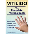 Vitiligo. Vitiligo causes, remedies, costs and treatment all included. The complete Vitiligo Book.