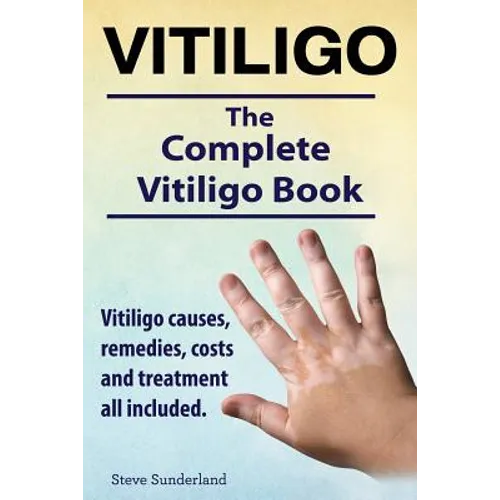 Vitiligo. Vitiligo causes, remedies, costs and treatment all included. The complete Vitiligo Book.