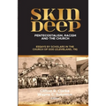Skin Deep: Pentecostalism, Racism and the Church: