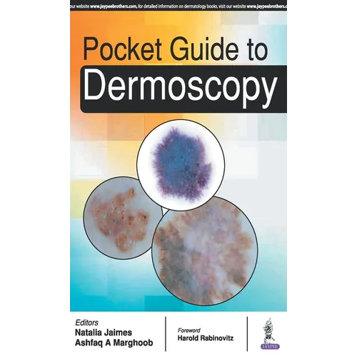 Pocket Guide to Dermoscopy