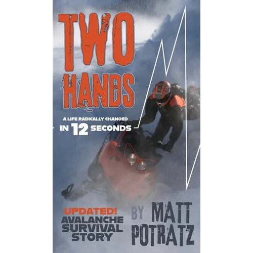 Two Hands: A Life Radically Changed In 12 Seconds