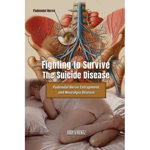 Fighting to Survive The Suicide Disease: Pudendal Nerve Entrapment and Neuralgia Disease