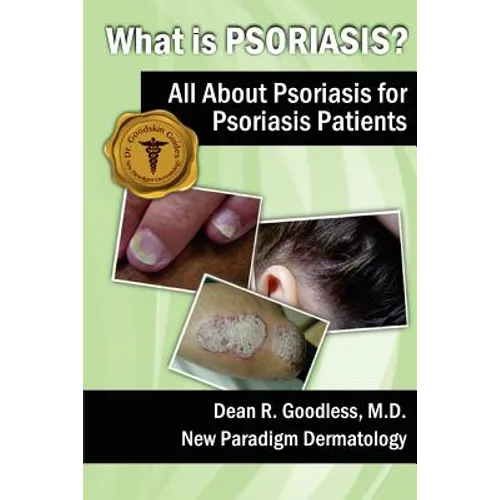What is Psoriasis?: All About Psoriasis for Psoriasis Patients