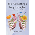 You Are Getting A Lung Transplant: An Example Guide