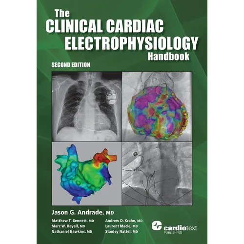 The Clinical Cardiac Electrophysiology Handbook, Second Edition
