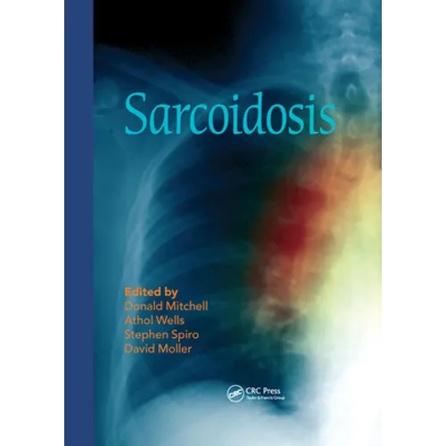 Sarcoidosis