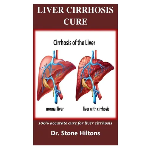 Liver Cirrhosis Cure: 100% accurate cure for liver cirrhosis