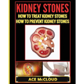 Kidney Stones: How To Treat Kidney Stones: How To Prevent Kidney Stones