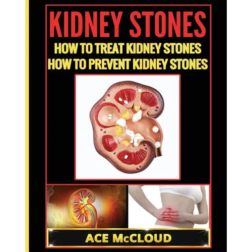 Kidney Stones: How To Treat Kidney Stones: How To Prevent Kidney Stones