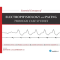 Essential Concepts of Electrophysiology and Pacing Through Case Studies