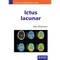 Ictus lacunar