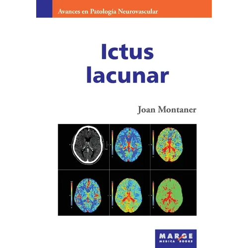 Ictus lacunar