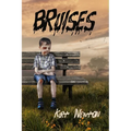 Bruises