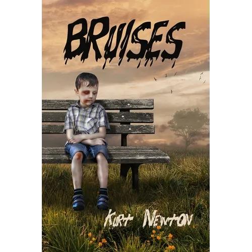 Bruises
