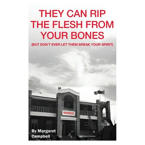 They Can Rip The Flesh From Your Bones