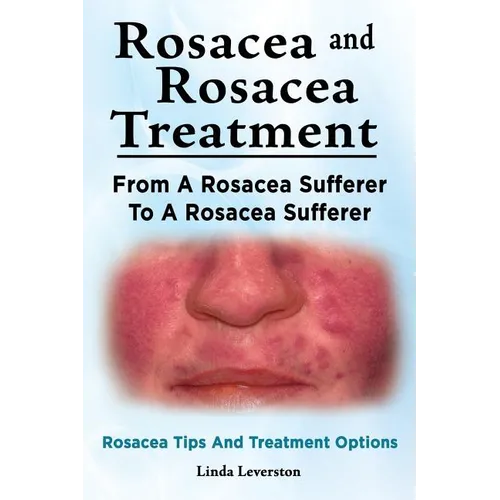 Rosacea and Rosacea Treatment. From A Rosacea Sufferer To A Rosacea Sufferer. Rosacea Tips And Treatment Options