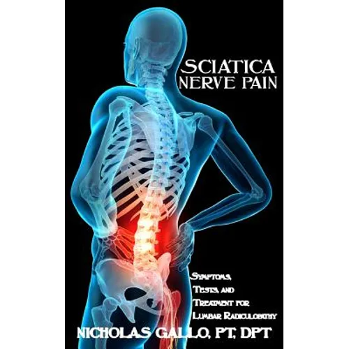 Sciatica Nerve Pain: Symptoms, Tests, and Treatments for Lumbar Radiculopathy