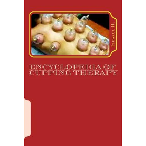 Encyclopedia of Cupping Therapy: Al-Hijama