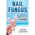 Nail Fungus: How to Naturally Cure Nail Fungus in 30 Days: Natural remedies, homeopathy for toenail fungus