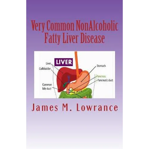 Very Common NonAlcoholic Fatty Liver Disease: How To Know if You Have Hepatic Steatosis