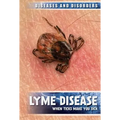 Lyme Disease: When Ticks Make You Sick