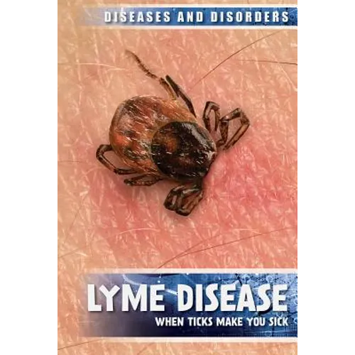 Lyme Disease: When Ticks Make You Sick
