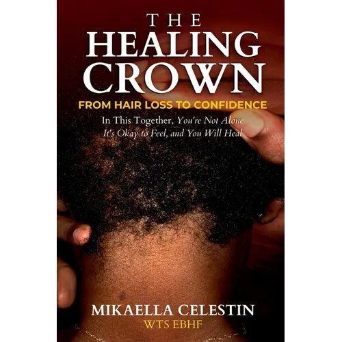 The Healing Crown: From Hair Loss to Confidence