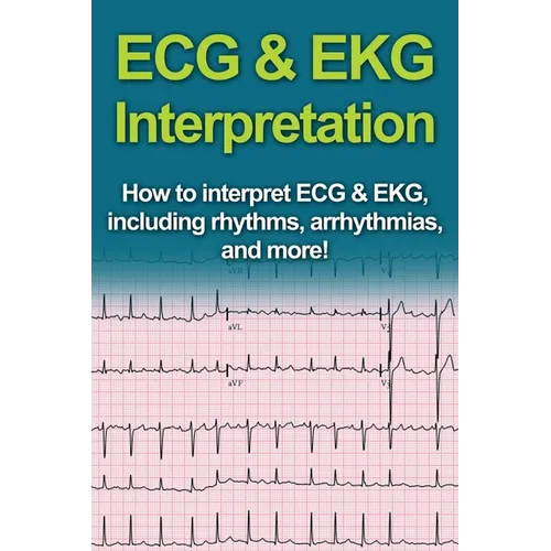 ECG & EKG Interpretation: How to interpret ECG & EKG, including rhythms, arrhythmias, and more!