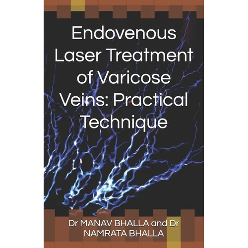 Endovenous Laser Treatment of Varicose Veins: Practical Technique