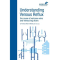 Understanding Venous Reflux the Cause of Varicose Veins and Venous Leg Ulcers: Varicose veins and venous leg ulcers