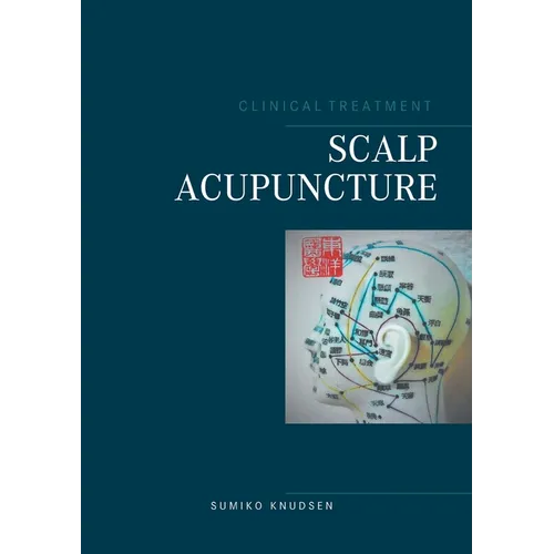 Scalp Acupuncture