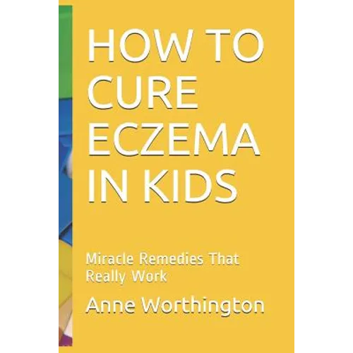 How to Cure Eczema in Kids: Miracle Remedies That Really Work
