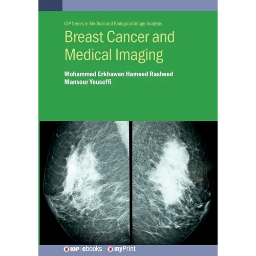 Breast Cancer and Medical Imaging