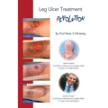 Leg Ulcer Treatment Revolution