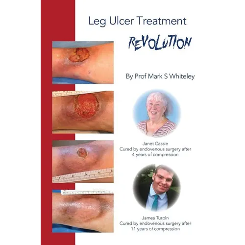 Leg Ulcer Treatment Revolution
