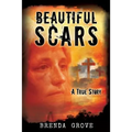 Beautiful Scars
