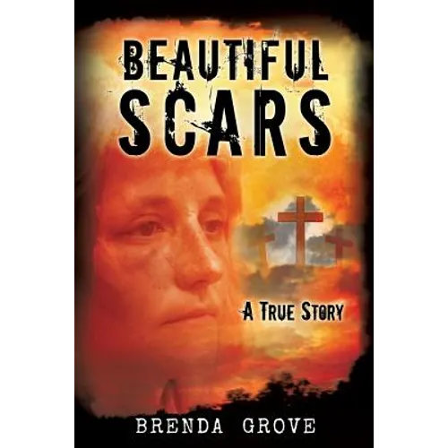 Beautiful Scars